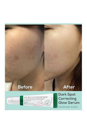 Axis-y Dark spot correcting glow serum